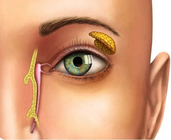 DCR surgery in Meerut| jawahar Eye Hospital